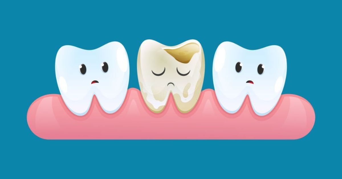 12 Broken Teeth Dream Interpretations
